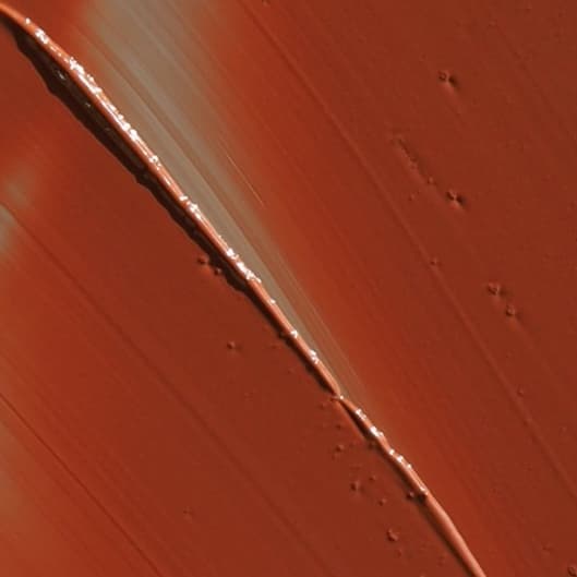 Follicle & Foundation